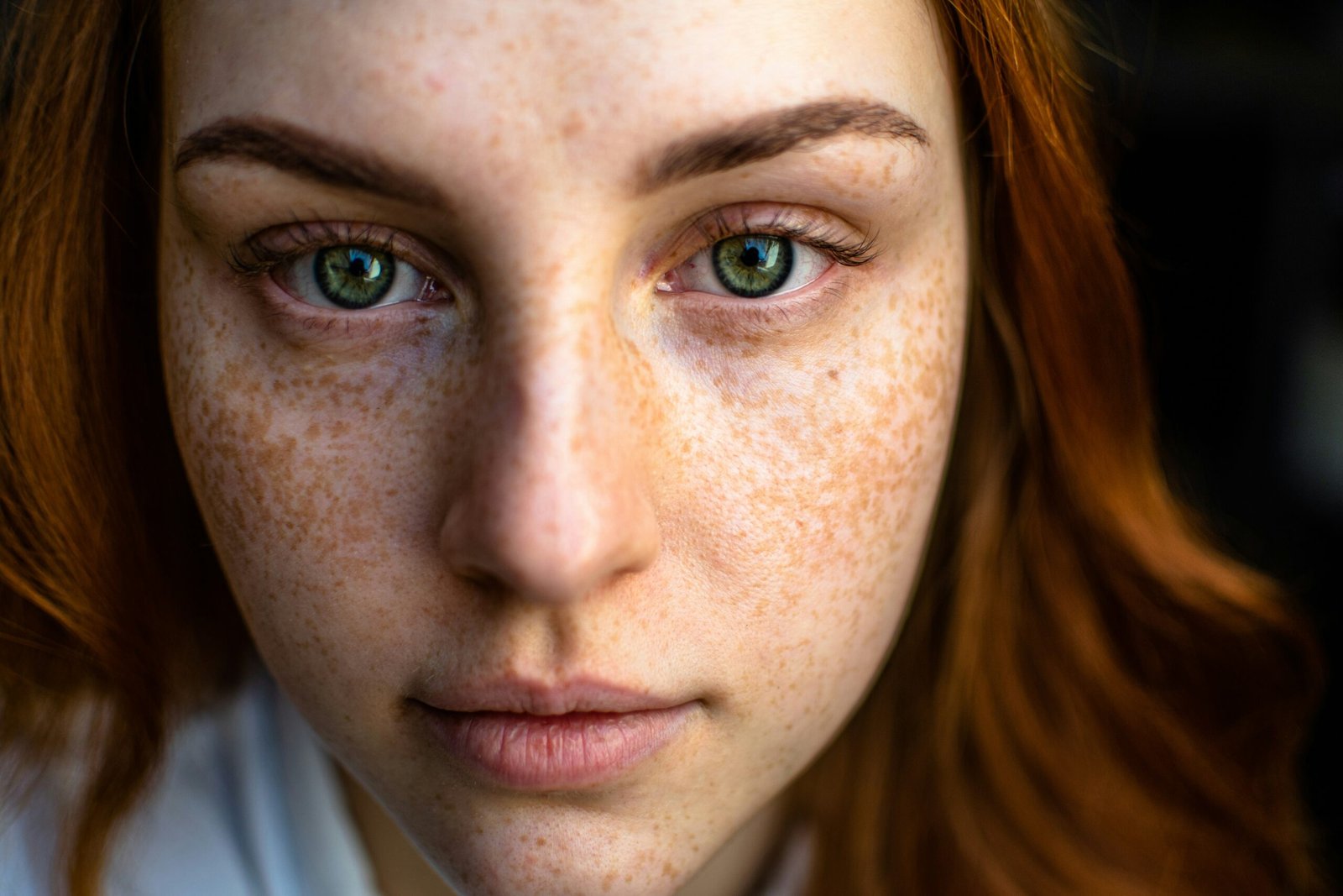 CBD for Acne