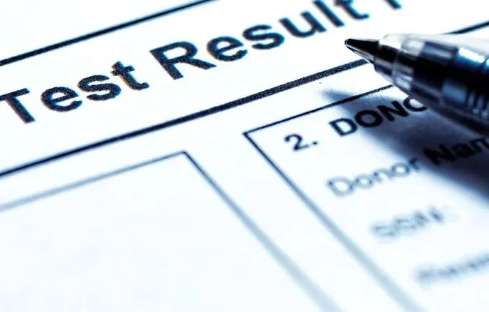 does cbd show up on a drug test