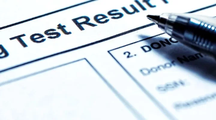 does cbd show up on a drug test