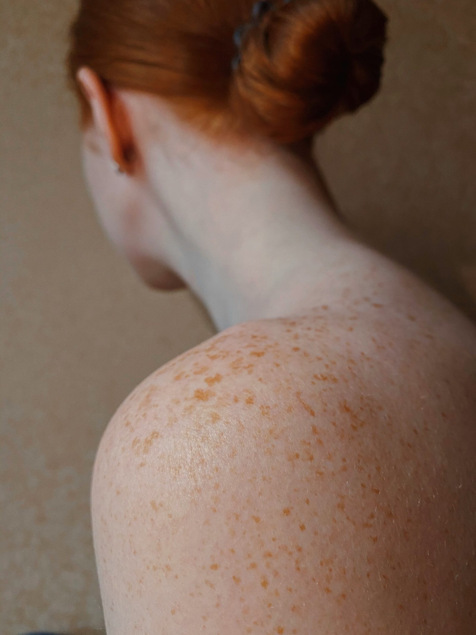 cbd oil for eczema uk