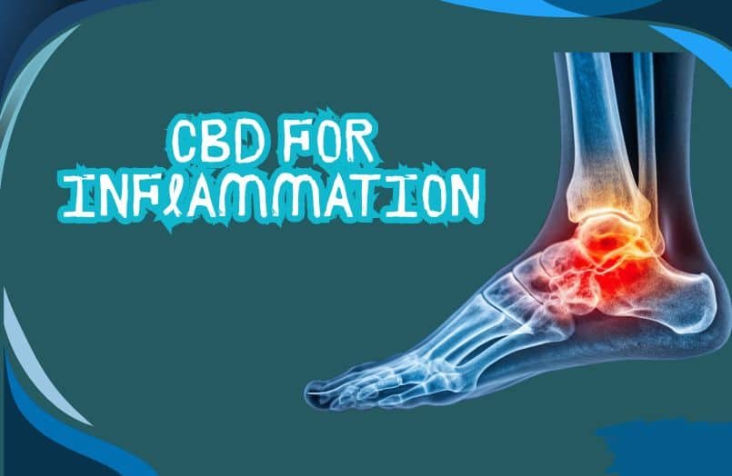 CBD for inflammation
