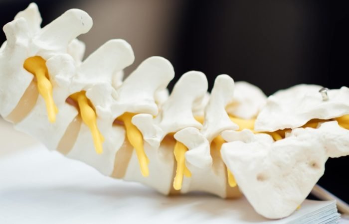 cbd oil for degenerative disc disease