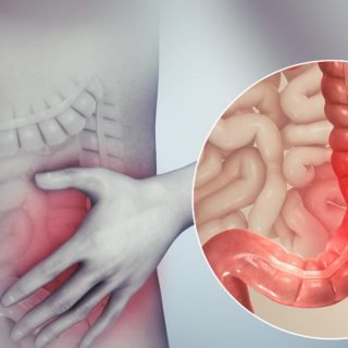 CBD for IBS